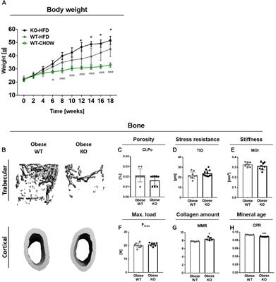 Thy-1 Deficiency Augments Bone Loss in Obesity by Affecting Bone Formation and Resorption